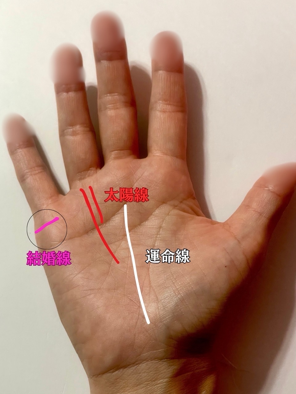 太陽線・運命線・結婚線の見方